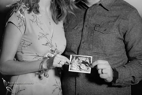 ultrasound baby photo
